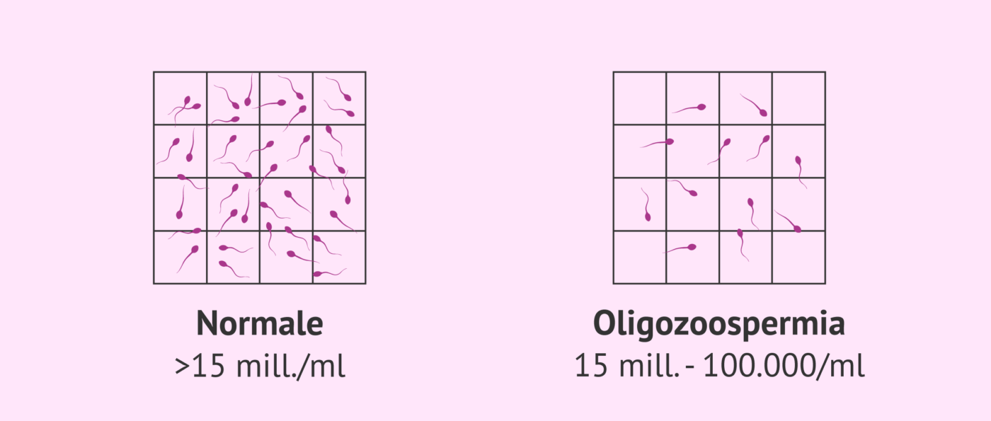 Test Online Fertilità Anonimo Oligospermia