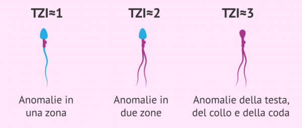 indice di teratozoospermia Test Online Fertilità Anonimo