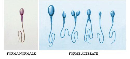 spermatozoi teratozoospermia Test Online Fertilità Anonimo